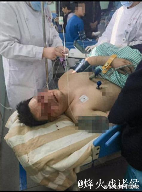 徐杰伤后返回基地视频曝光!左眼贴纱布无大碍! 徐杰伤后返回基地视频曝光!左眼贴纱布无大碍!